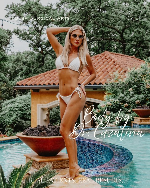 Real patient of Tulsa Surgical Arts — body contouring by Dr. Cuzalina