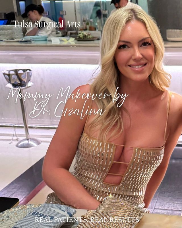 Real patient of Tulsa Surgical Arts — mommy makeover by Dr. Cuzalina