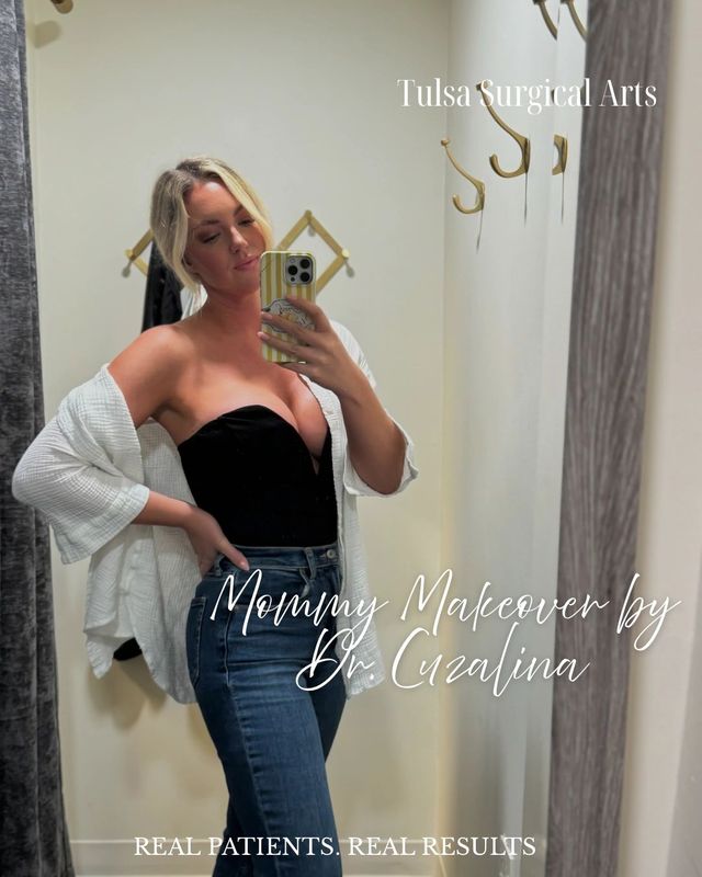 Real patient of Tulsa Surgical Arts — mommy makeover by Dr. Cuzalina